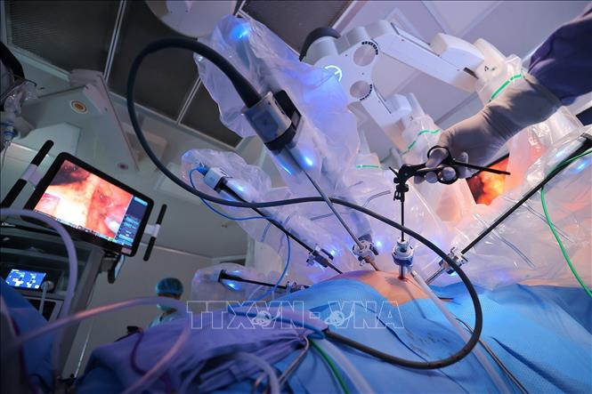Hệ thống Robot Da Vinci được trang bị camera nội soi 3D độ phân giải cao cùng các cánh tay robot có khả năng xoay linh hoạt, mô phỏng chính xác chuyển động của bàn tay con người nhưng với độ ổn định và chính xác vượt trội. (Ảnh: Minh Quyết/TTXVN)